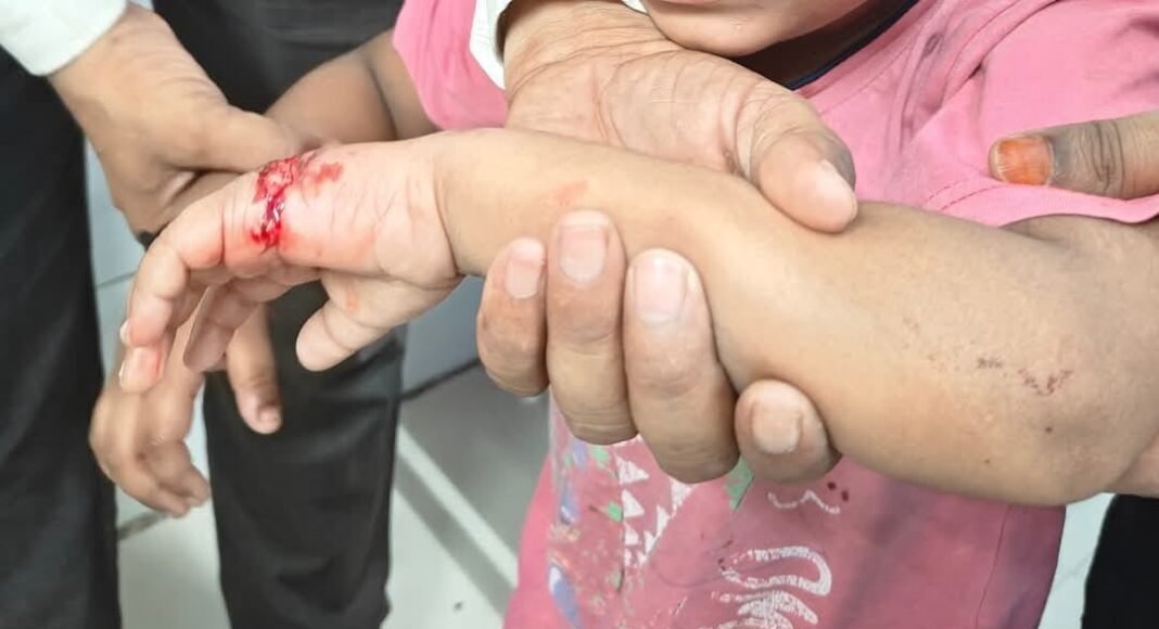 लखनऊ में आवारा कुत्तों का आतंक: मलाही टोला, अब्बास नगर में बच्चों पर हमला, नगर निगम की लापरवाही पर सवाल