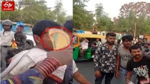 लखनऊ में भिखारी रेस्क्यू टीम पर हमला