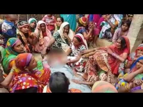 मेथा की टंकी फटने से ,हाई स्कूल की टॉपर क्षात्रा बुरी तरह झुलसी
